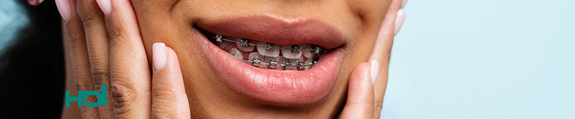 Serviço Pasta ortodôntica HDi Imagens